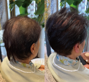 富山の女性の髪質改善ボリュームアップ