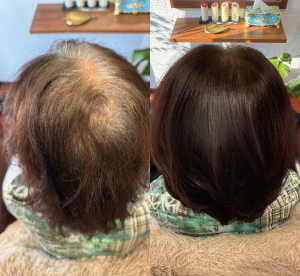 富山の女性の髪質改善ボリュームアップ